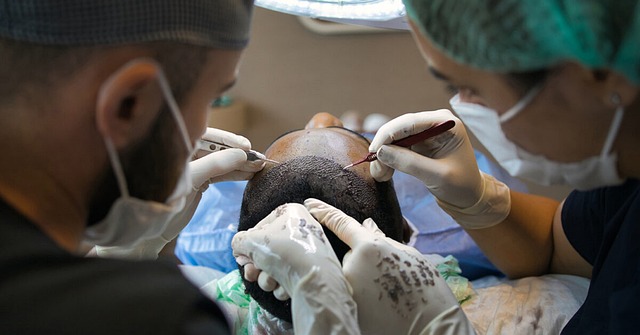 Fra skaldet til skinnende: Hvordan du får den bedste hårtransplantation